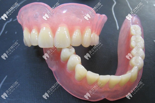 松風塑鋼牙示意圖