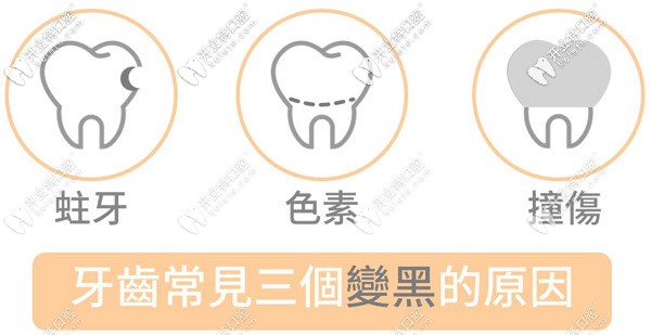兒童牙齒黑斑是什么原因引起的，需要治療嗎？
