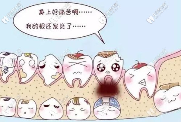 根管治療費(fèi)用能報(bào)銷嗎