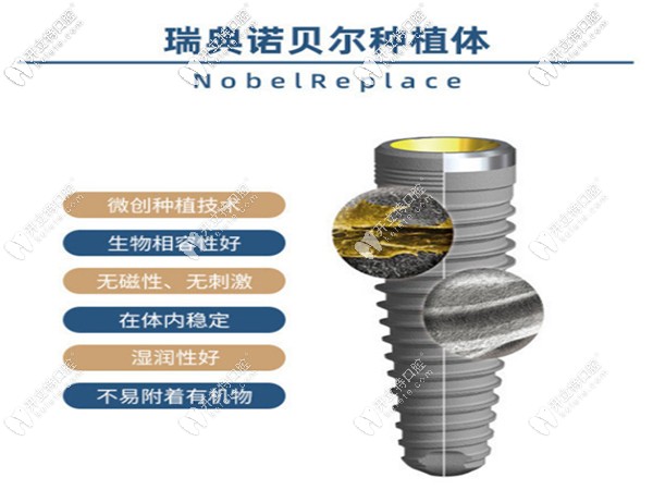 南京博韻瑞典諾貝爾種植體價(jià)格