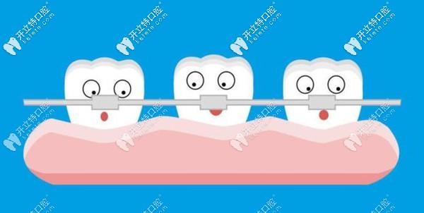 南京博韻口腔牙齒矯正價(jià)格