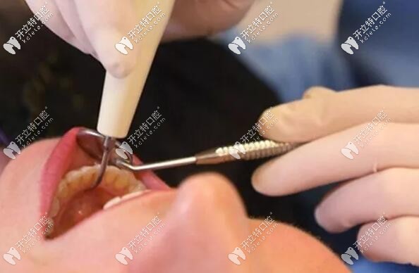 有高血壓、糖尿病等病史的能拔牙嗎