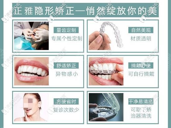 長沙德韓牙科—正雅隱形牙套優(yōu)勢