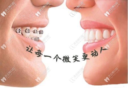矯正讓牙齒更動(dòng)人