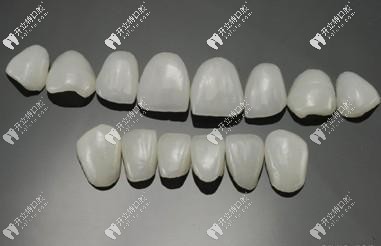 牙齒瓷貼面中的琥珀瓷和藍(lán)瓷貼面區(qū)別大嗎?哪個(gè)好？