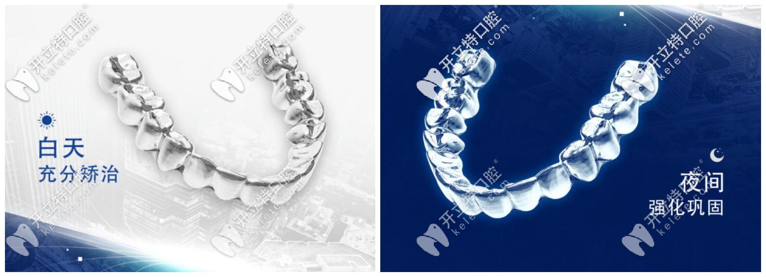 正雅日夜版雙膜隱形牙套效果怎么樣？入手價(jià)格大概是多少