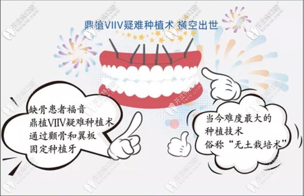 湖州鼎植VIIV疑難種植術(shù)