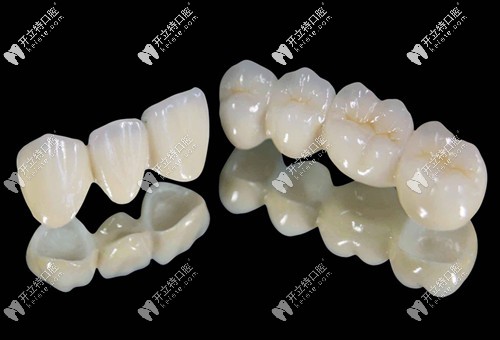全瓷牙外觀