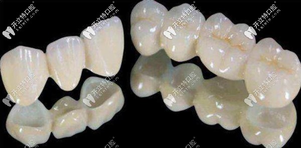 美晶瓷PK愛爾創(chuàng)全瓷牙優(yōu)缺點(diǎn)