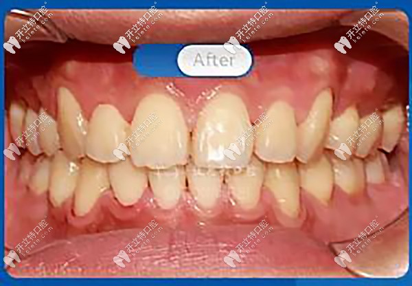 笑容自信陽(yáng)光有感染力