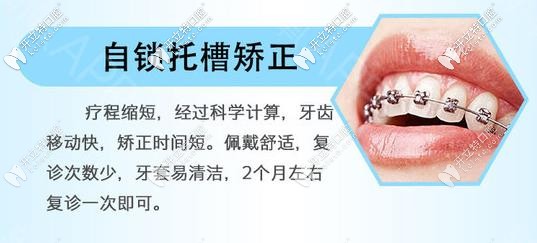 國產指定金屬自鎖矯正器優(yōu)勢