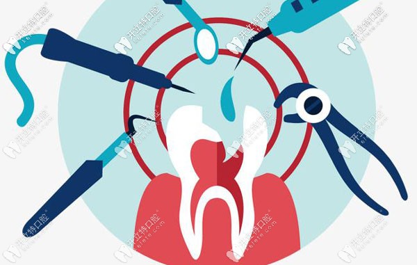 拔牙后多久種牙和牙位也有關(guān)