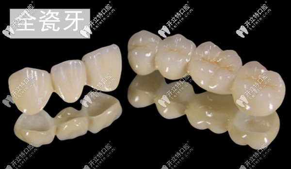 深圳正夫口腔愛(ài)爾創(chuàng)全瓷牙冠多少錢