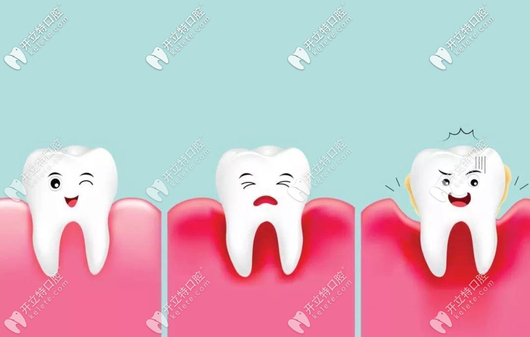 牙周炎引起的牙齒松動