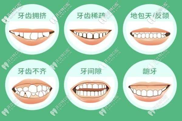 深圳正夫口腔牙齒矯正的費(fèi)用