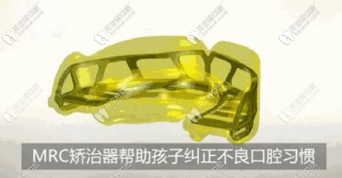 MRC肌功能矯治器：有效幫助孩子矯正不良口腔習慣