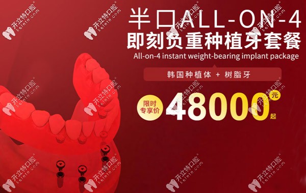 這個是上海維樂口腔半口種植牙的活動