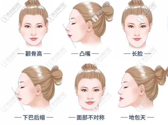 牙齒矯正適應(yīng)性