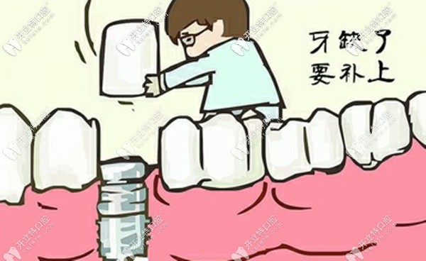 探查到湖州鼎植口腔醫(yī)院院長(zhǎng)蘇艷國(guó)做種植牙的技術(shù)如何咯!