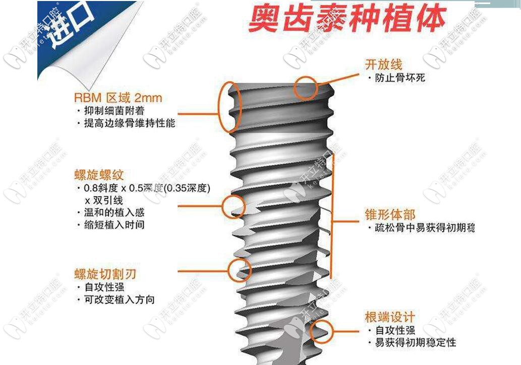 來看看奧齒泰種植體怎么樣