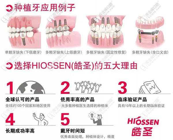 皓圣ETIII SA種植體，支持延期種植又擅于即刻種植