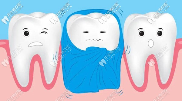 青島各牙科醫(yī)院補(bǔ)牙多少錢一顆