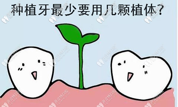 全口種植牙較少要做多少顆？其實(shí)跟種牙方案的選擇有關(guān)