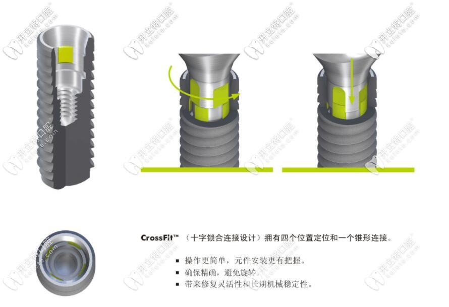 十字鎖合連接示