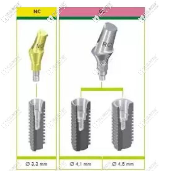 nc和rc對應(yīng)種植體直徑示意圖