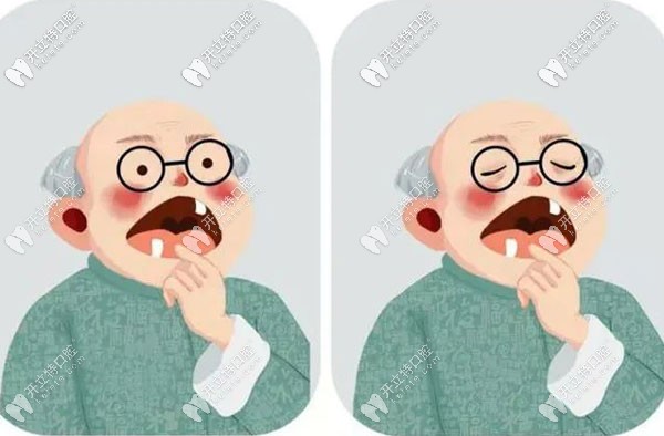 試問(wèn)種植牙咀嚼功能怎么樣,和自己的真牙咀嚼效率一樣嗎？