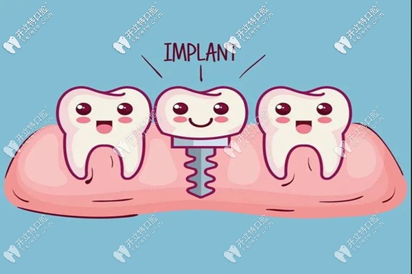 邢臺(tái)種植牙一般多少錢一顆,還想打卡醫(yī)生技術(shù)好的牙科
