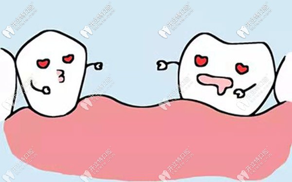 烤瓷和聚合瓷哪個(gè)更耐用
