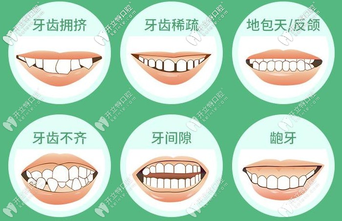 牙齒矯正的適應(yīng)癥狀