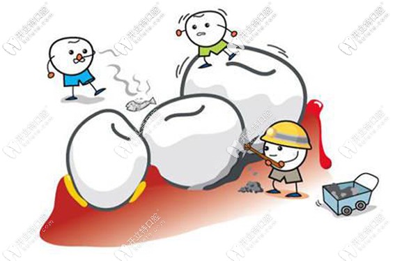 柳州各牙科看牙項(xiàng)目收費(fèi)匯總