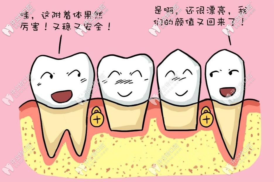 無(wú)掛鉤假牙 