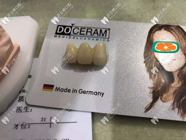 杜塞拉姆氧化鋯全瓷牙優(yōu)點