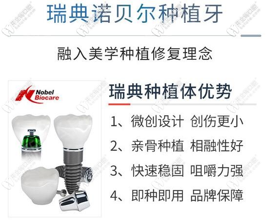 深圳勝健口腔瑞典諾貝爾種植牙優(yōu)勢