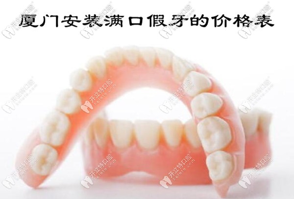 廈門安裝滿口假牙的價格表來嘍
