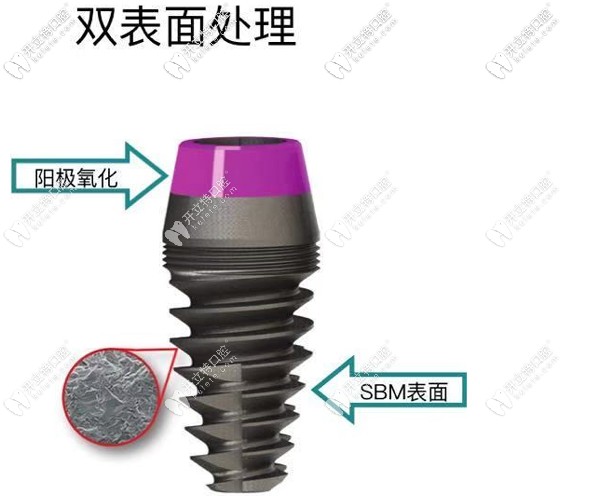 美國(guó)艾迪AIDI種植牙怎么樣，從aidi植體特點(diǎn)及價(jià)格來(lái)看