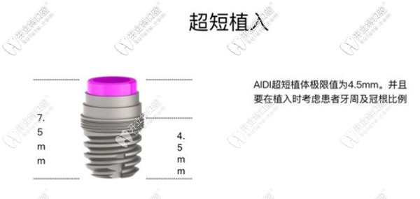 艾迪種植體的優(yōu)勢(shì)