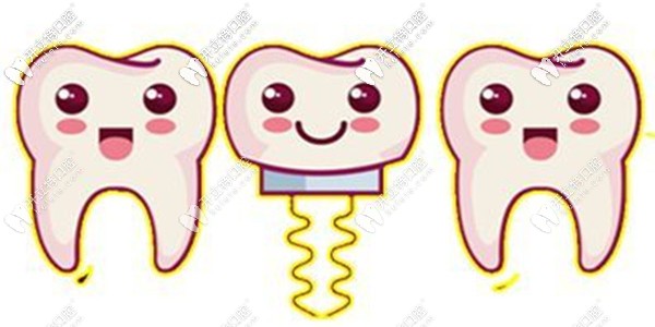 博韻口腔種植牙多少錢(qián)