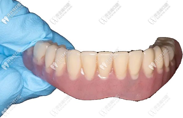 無種植仿生牙示意圖