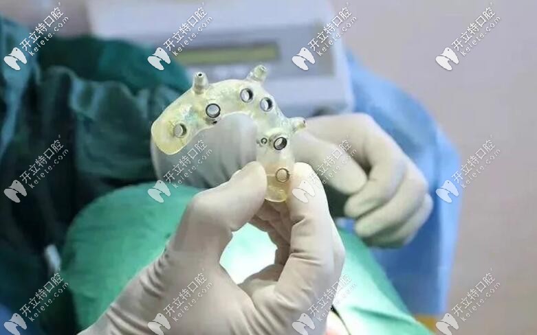 這是用來在定制植體的材料