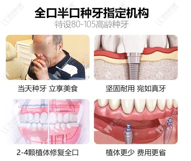 中諾是全口半口種植牙指定機(jī)構(gòu)