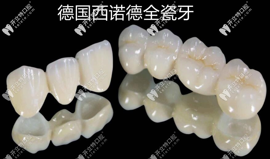 德國(guó)西諾德全瓷牙品牌