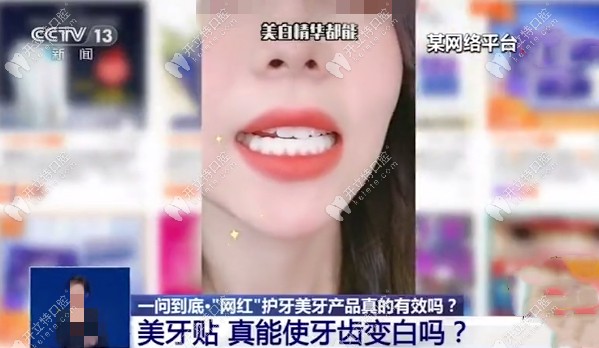 網(wǎng)紅試用美白牙貼的視頻圖
