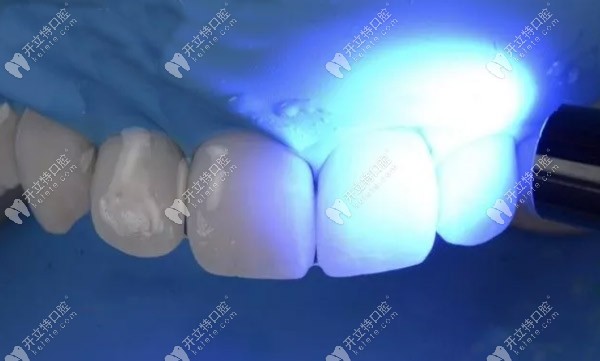 用甘油凝膠實現(xiàn)光固化程序