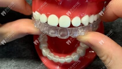 咬膠前一定要戴好透明牙套