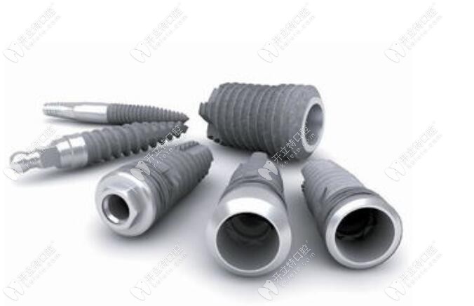 登騰種植牙的費(fèi)用