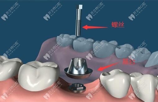 放入基臺并使用螺絲擰緊